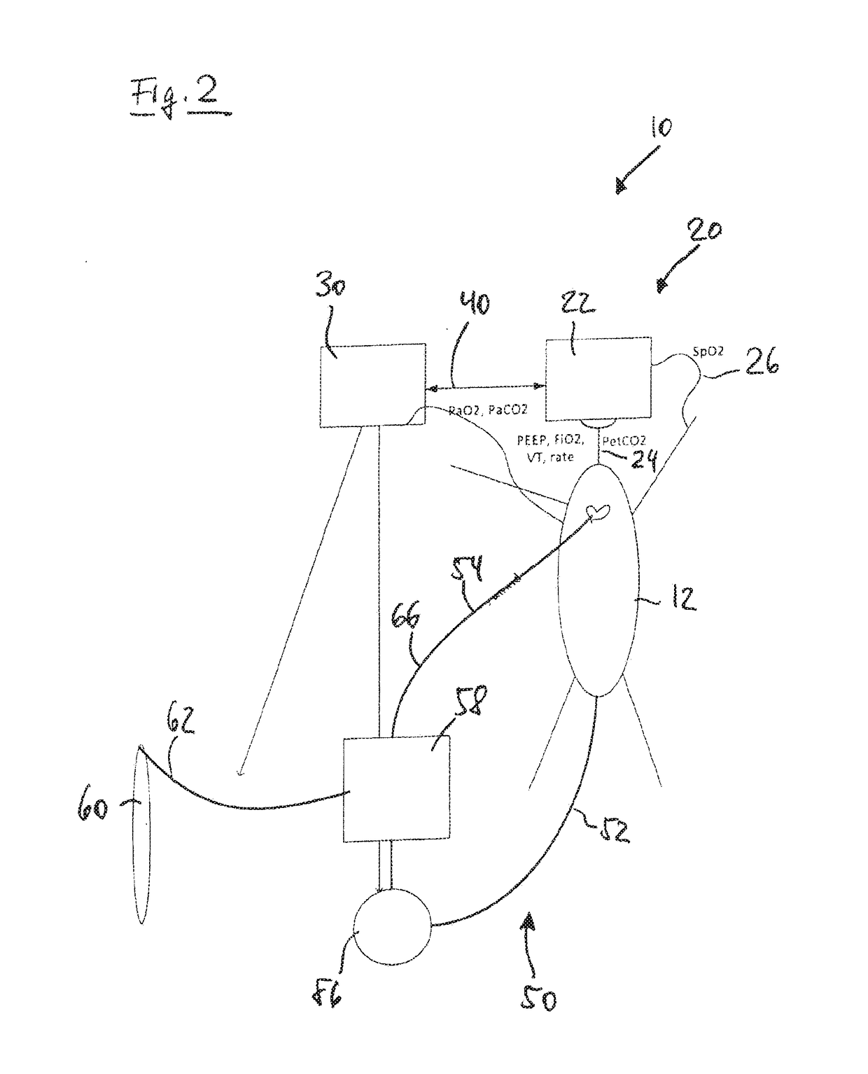 Ventilation system with mechanical ventilation and extracorporeal blood gas exchange