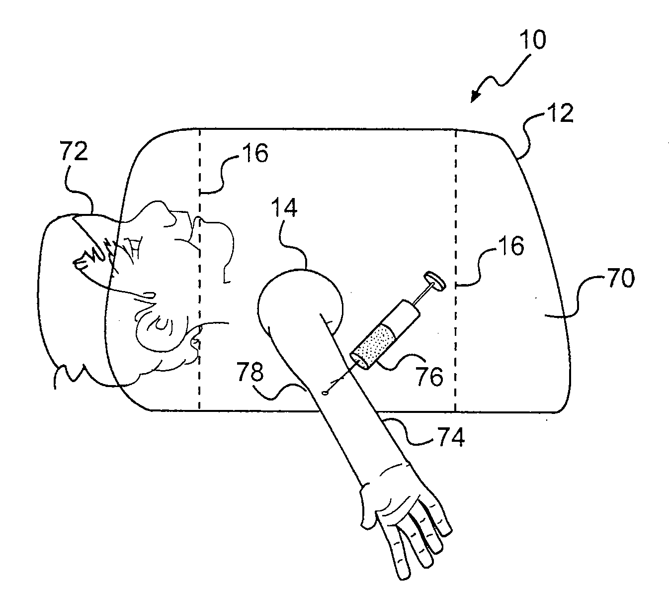 Diversion board/diversion shield