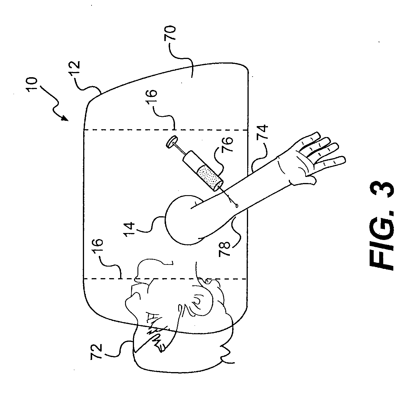 Diversion board/diversion shield