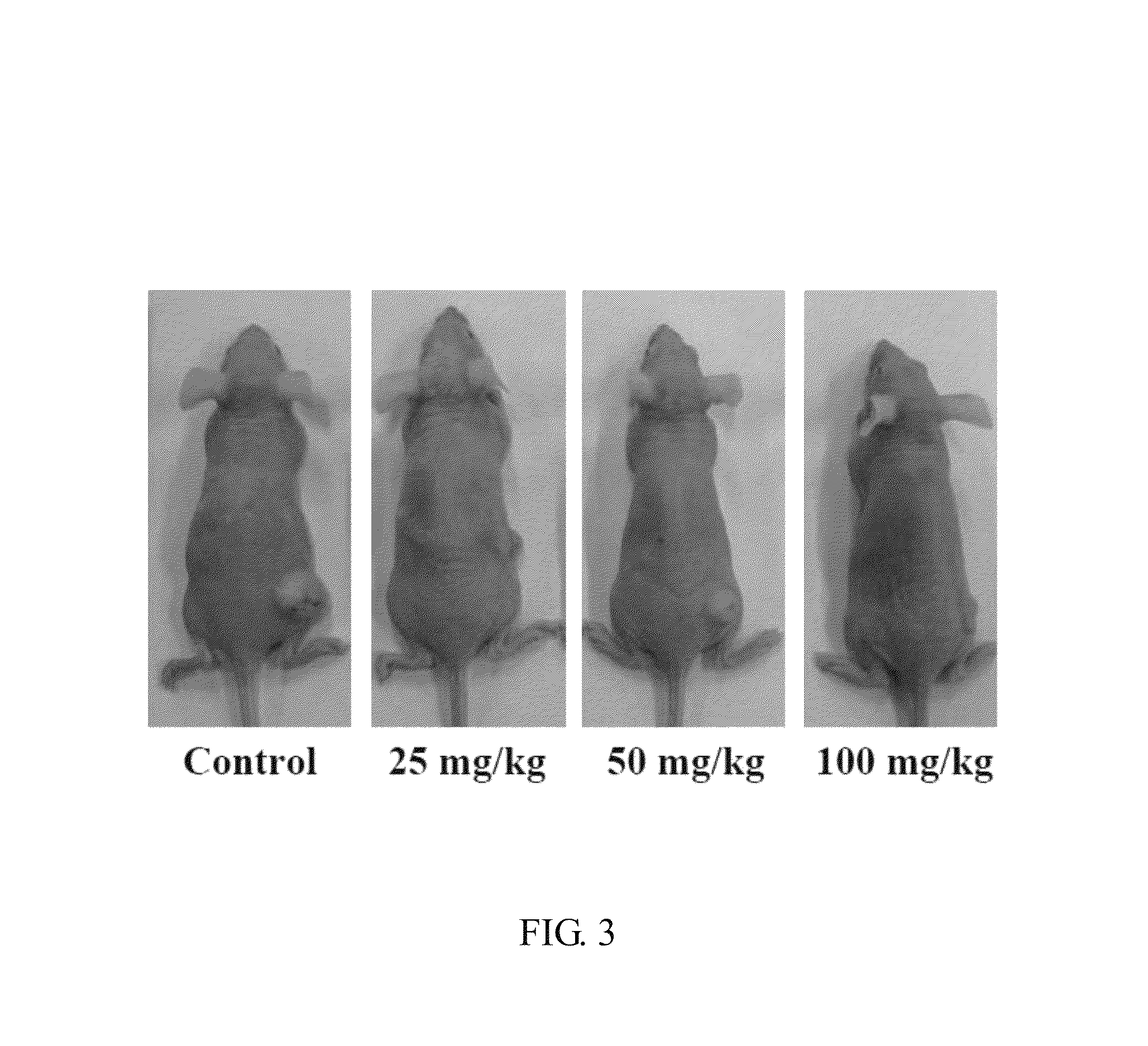 Stilbenoid compound as inhibitor for squamous carcinoma and hepatoma and uses thereof