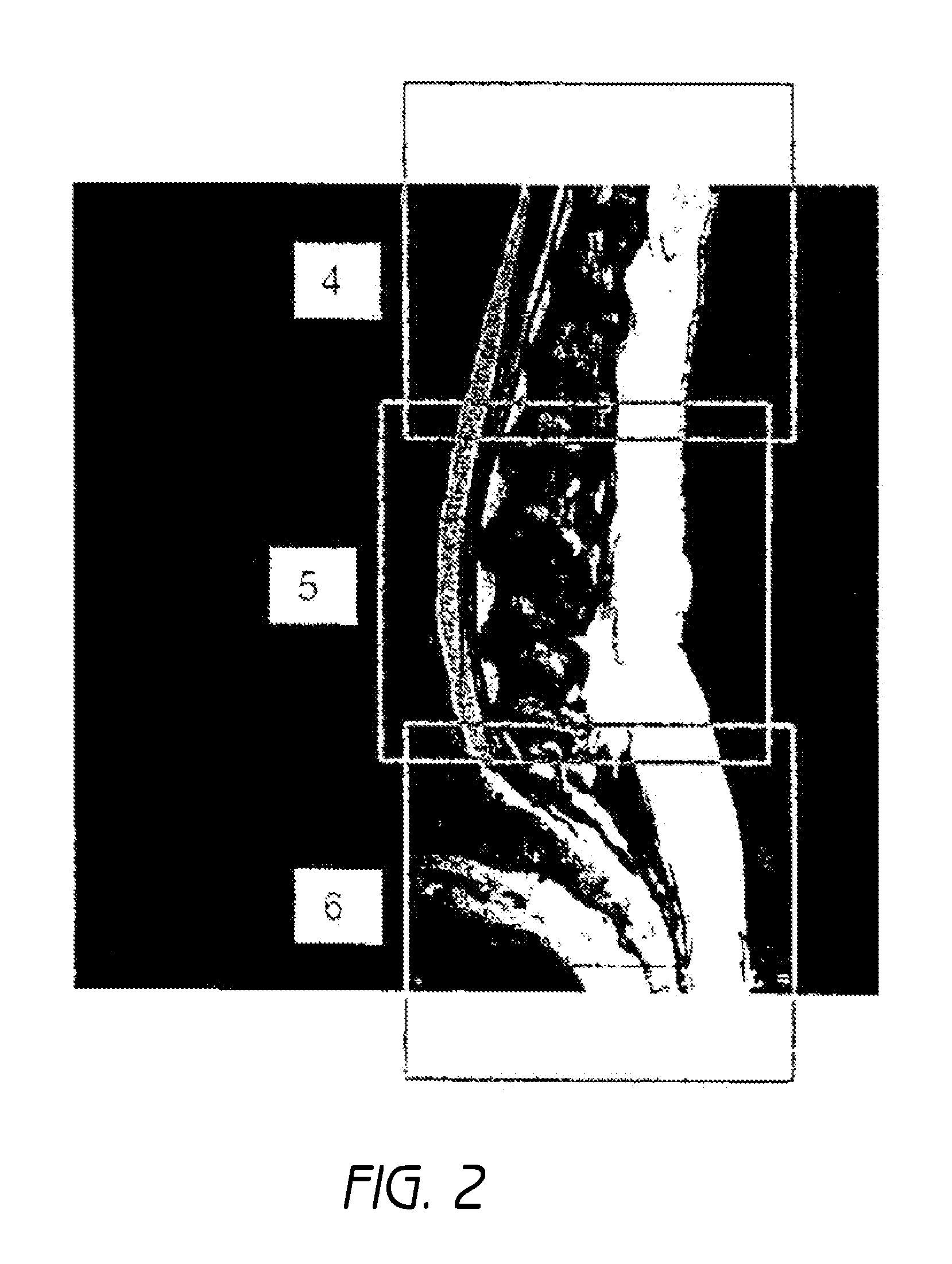 Mr spectroscopy system and method for diagnosing painful and non-painful intervertebral discs