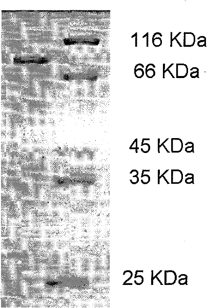 Protective antigen mutant of Bacillus anthracis