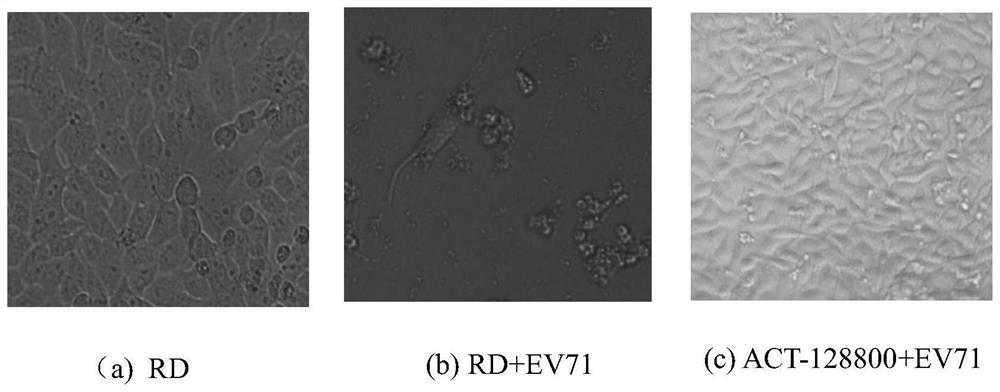 Application of Ponesimod compound in preparation of anti-EV71 virus drugs