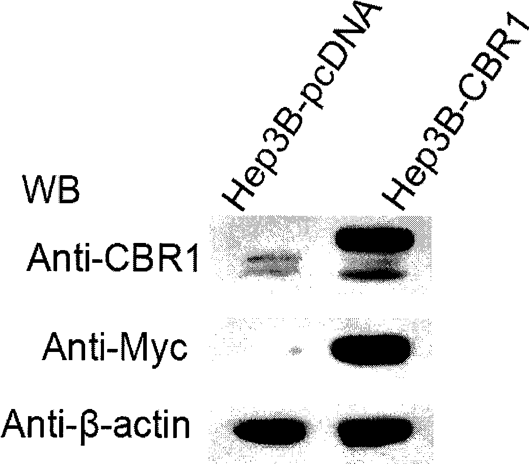 Combination of epigallocatechin-3-gallate and cerubidin and use thereof