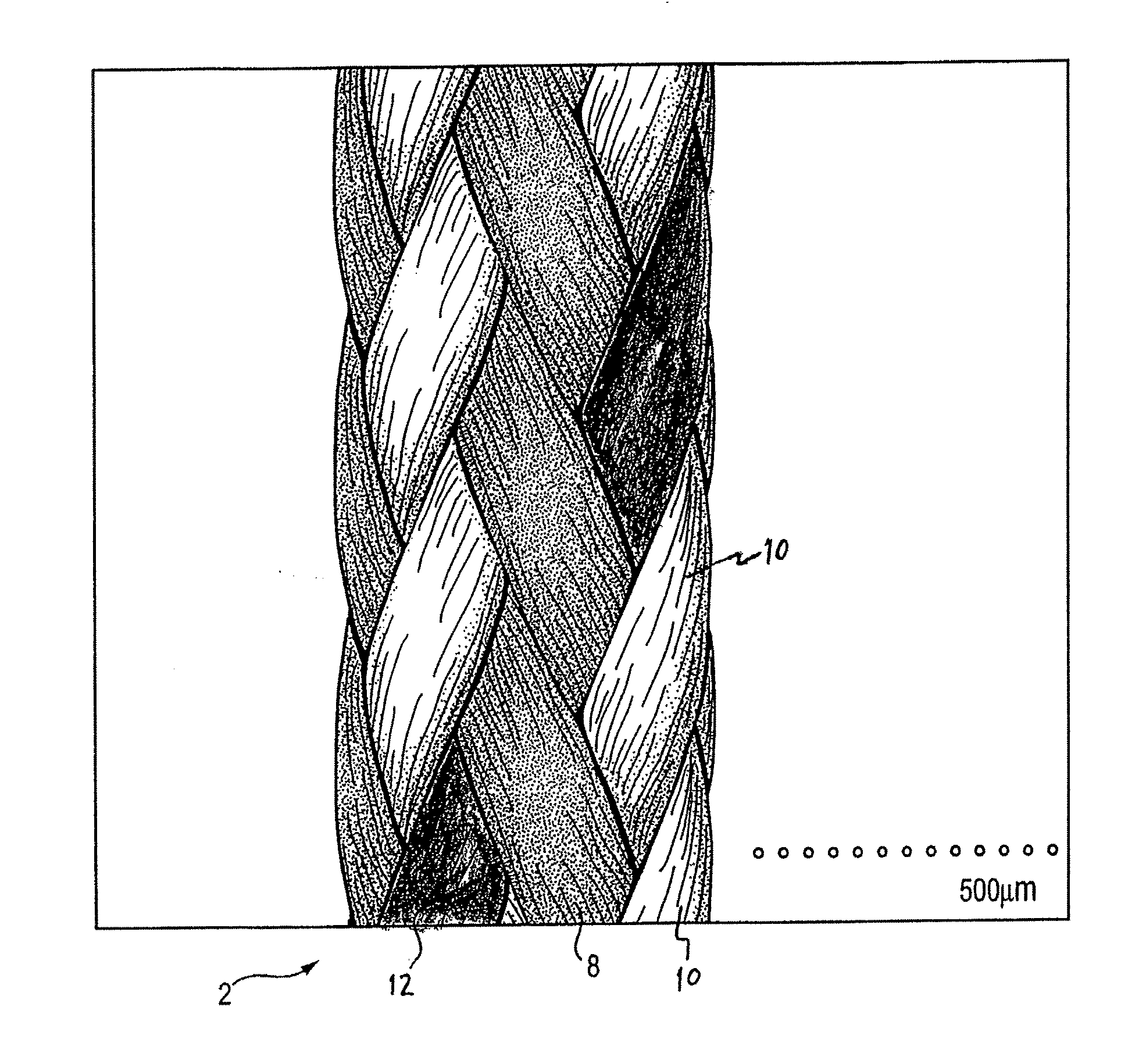 High strength suture coated with collagen