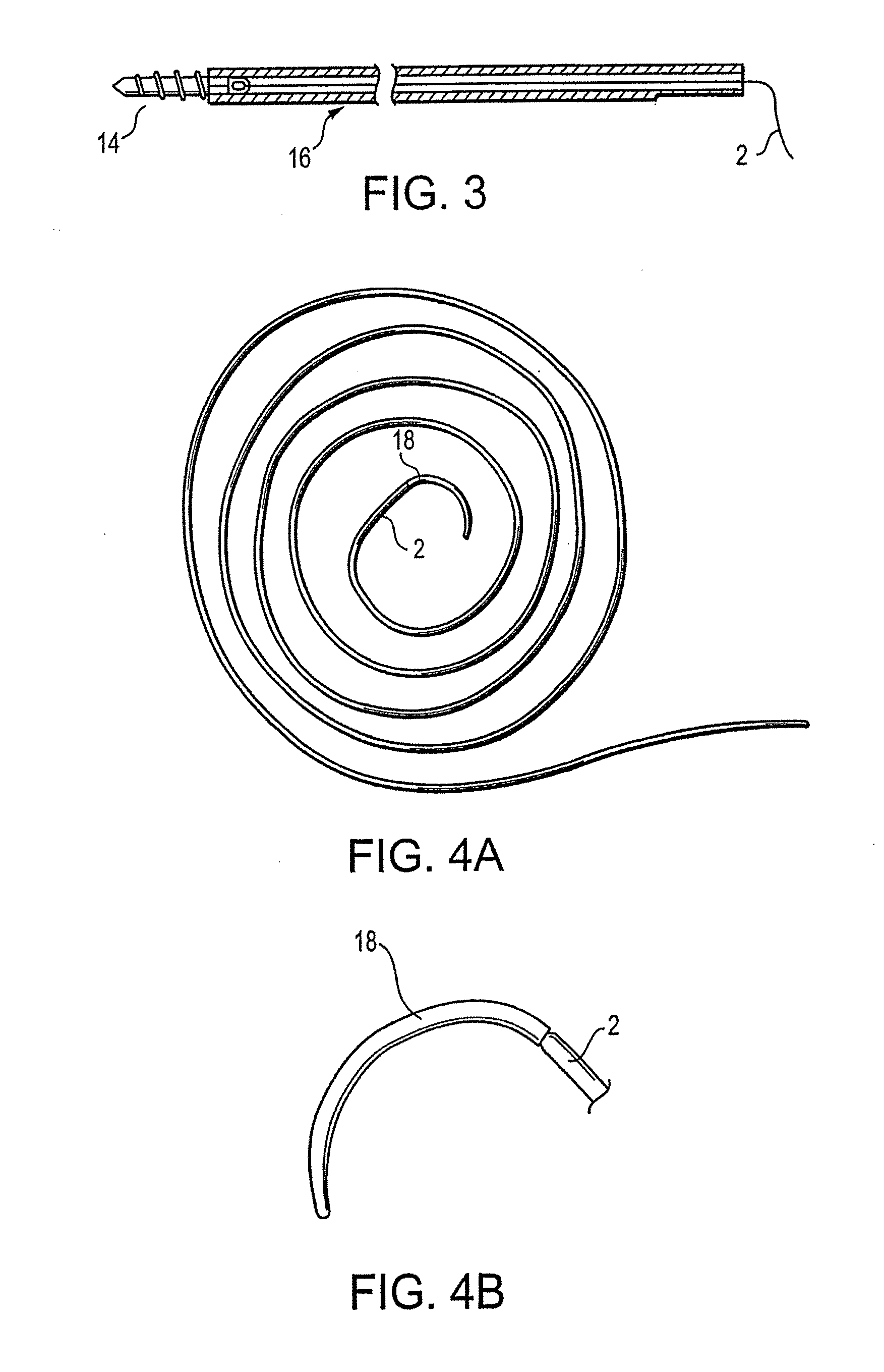 High strength suture coated with collagen