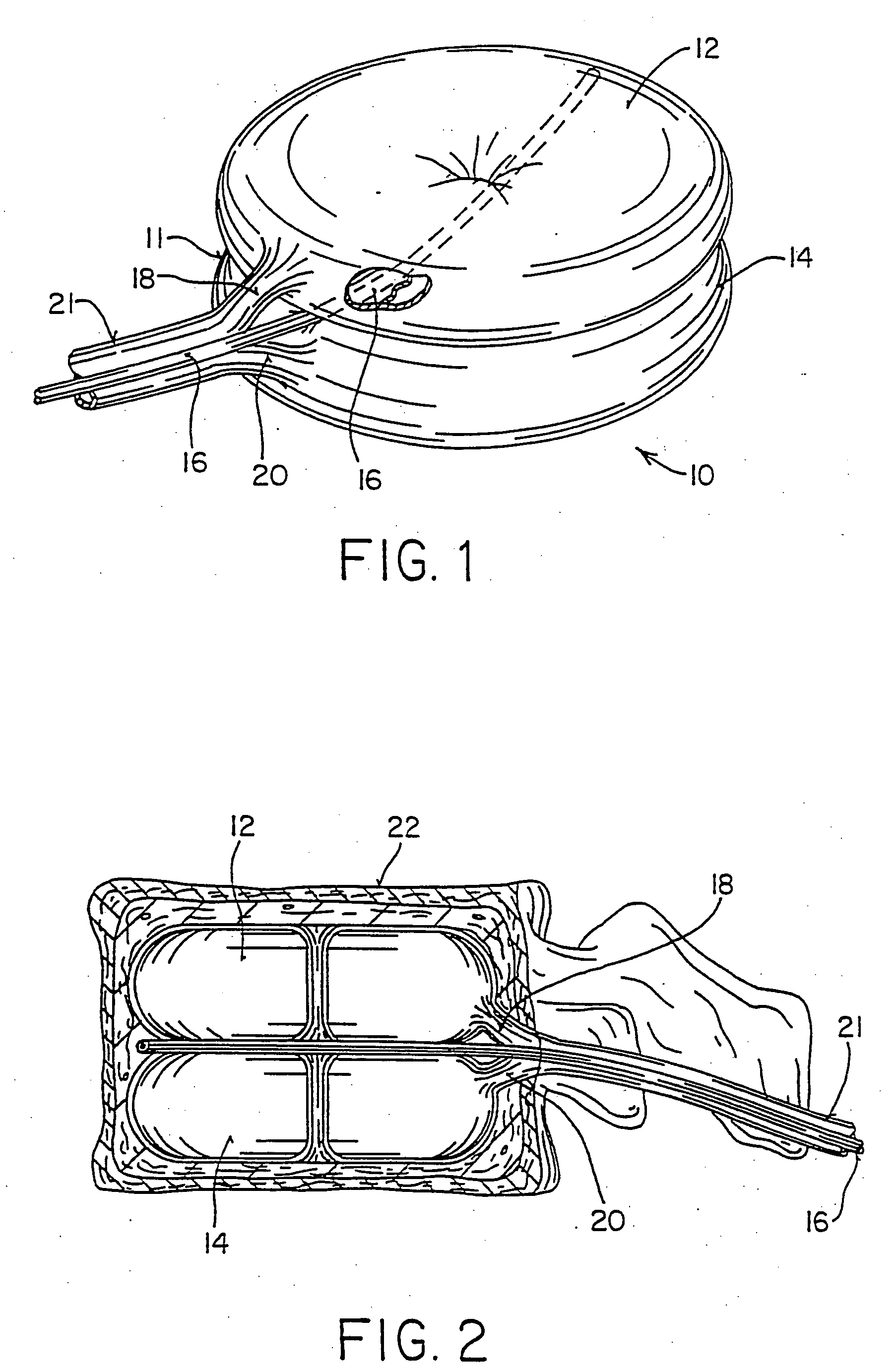 Inflatable device for use in surgical protocol relating to fixation of bone