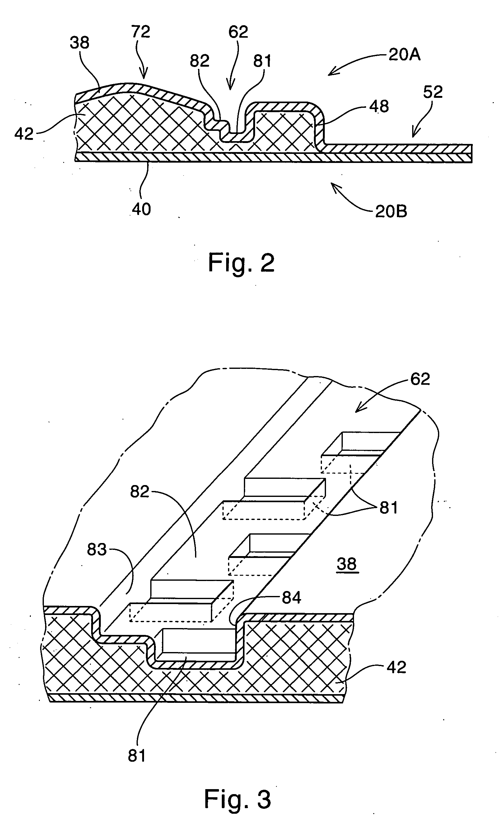 Absorbent article having traverse reinforcing element