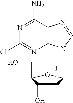 Methods and compositions for the treatment of lupus using clofarabine