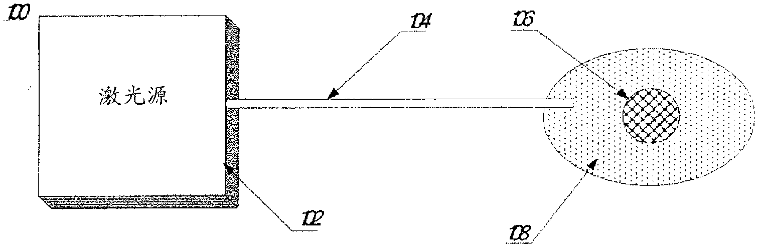 Method and apparatus for laser lithotripsy