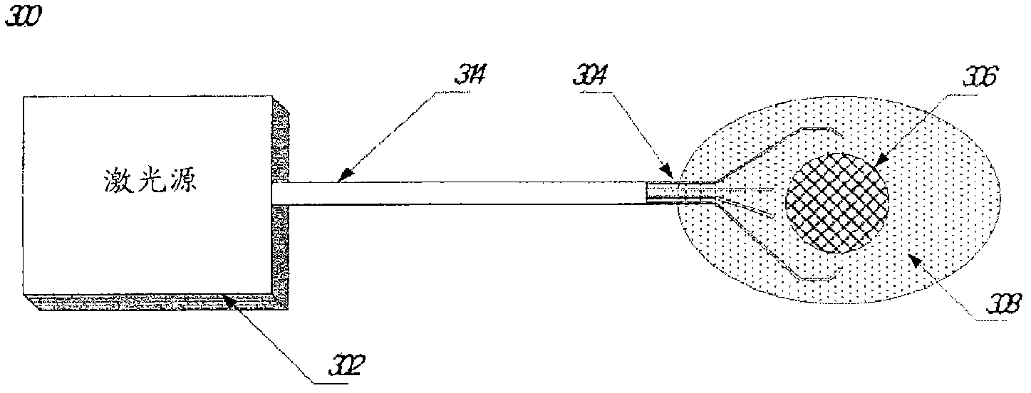 Method and apparatus for laser lithotripsy