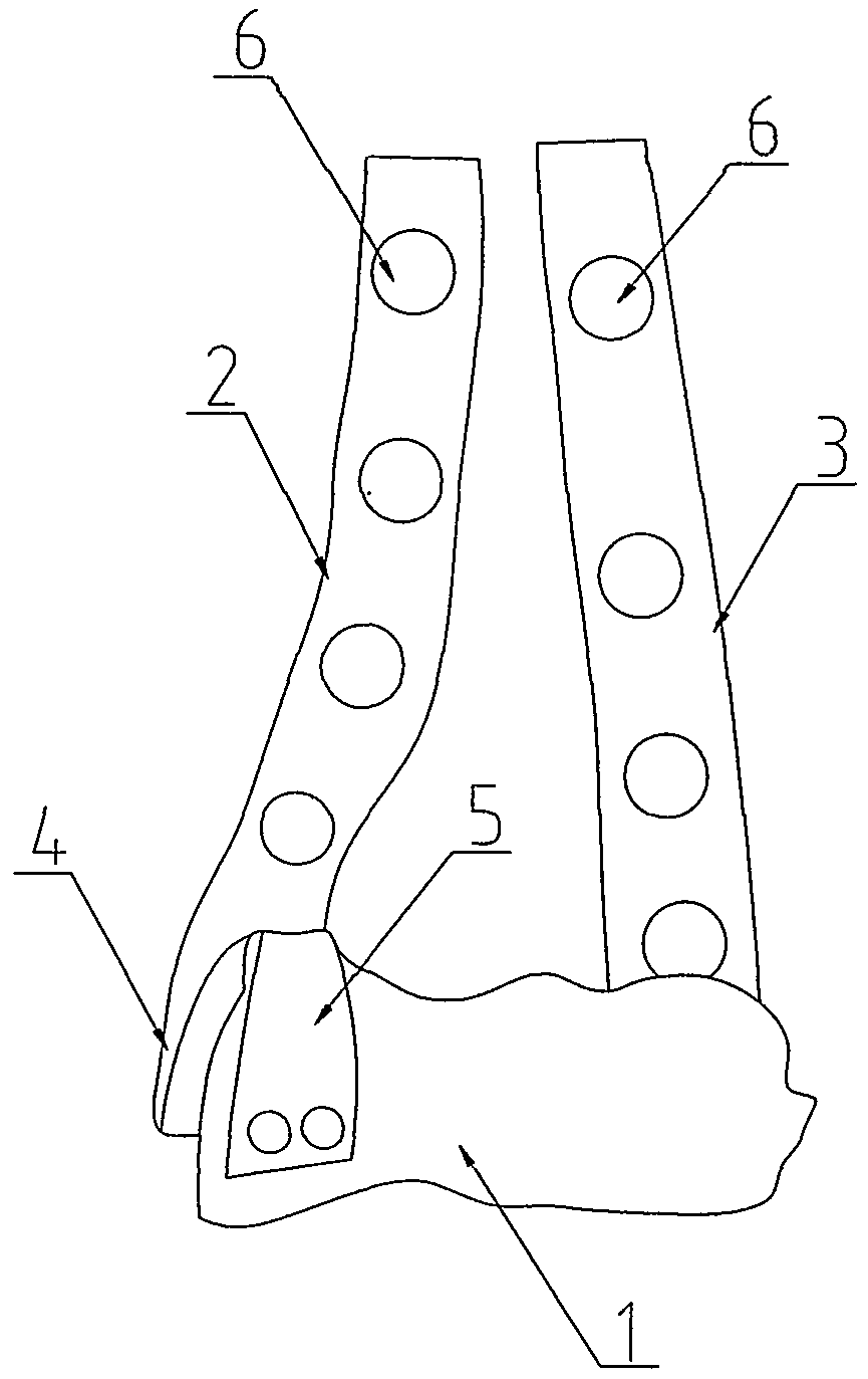 A kind of artificial elbow joint surface replacement prosthesis