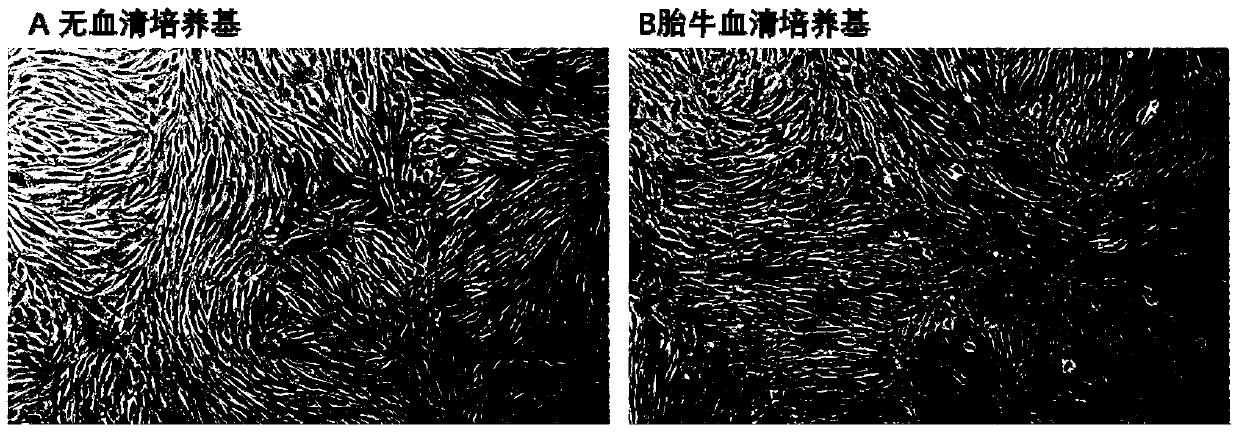 Mesenchymal stem cell chemical component limited serum-free culture medium and application thereof