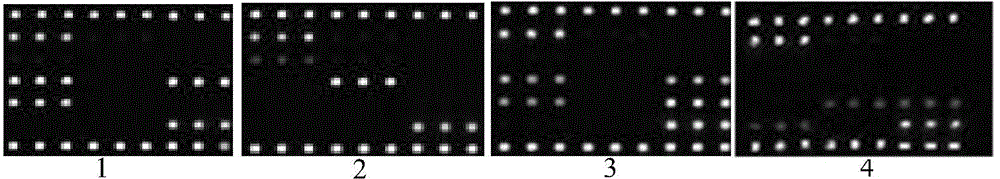 Gene chip, kit and method for detecting three viruses for immunosuppression disease of chickens