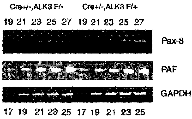 Method for searching ALK3 downstream gene related to congenital heart disease-ventricular septal defect