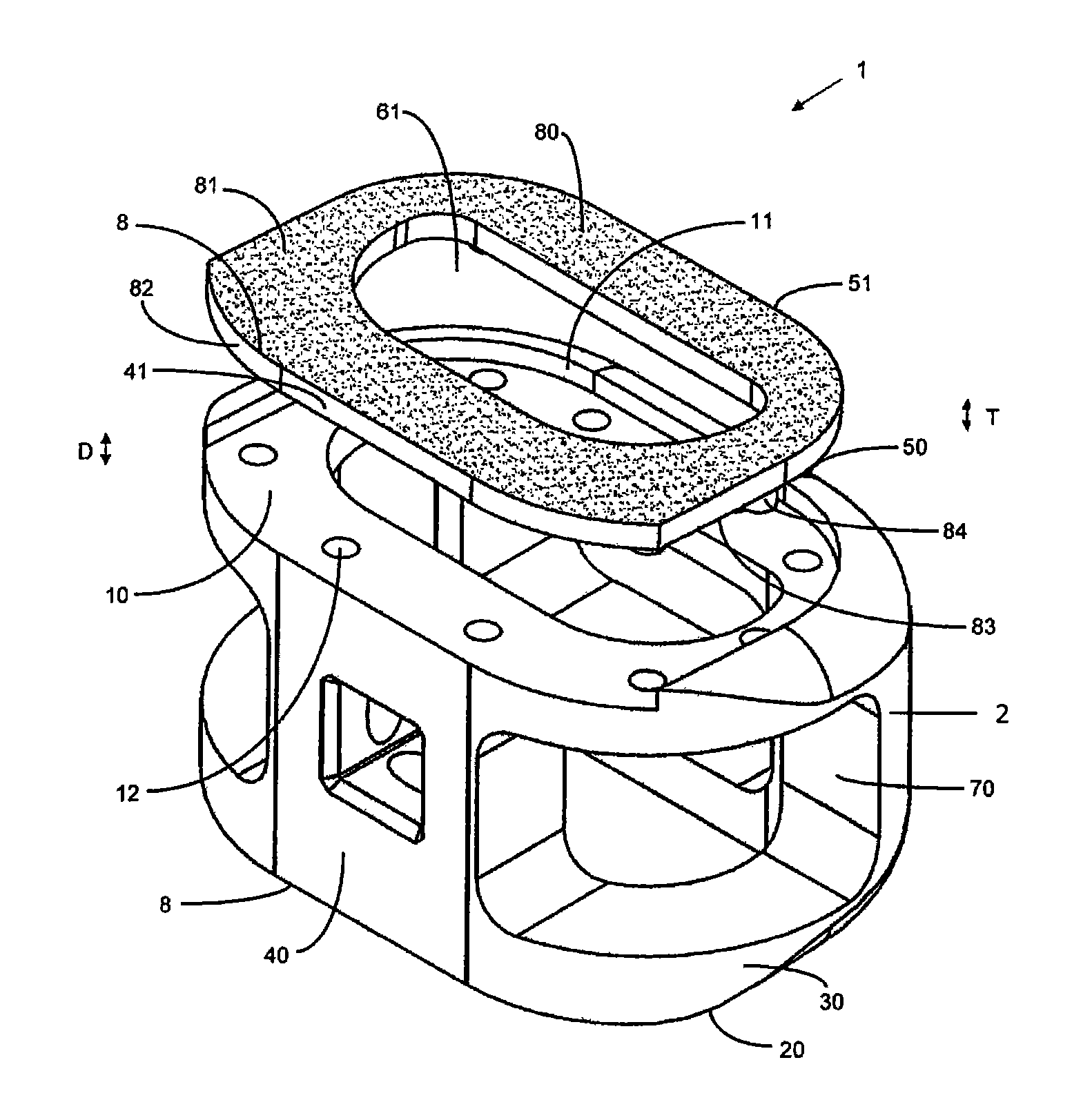 Composite implants having integration surfaces composed of a regular repeating pattern