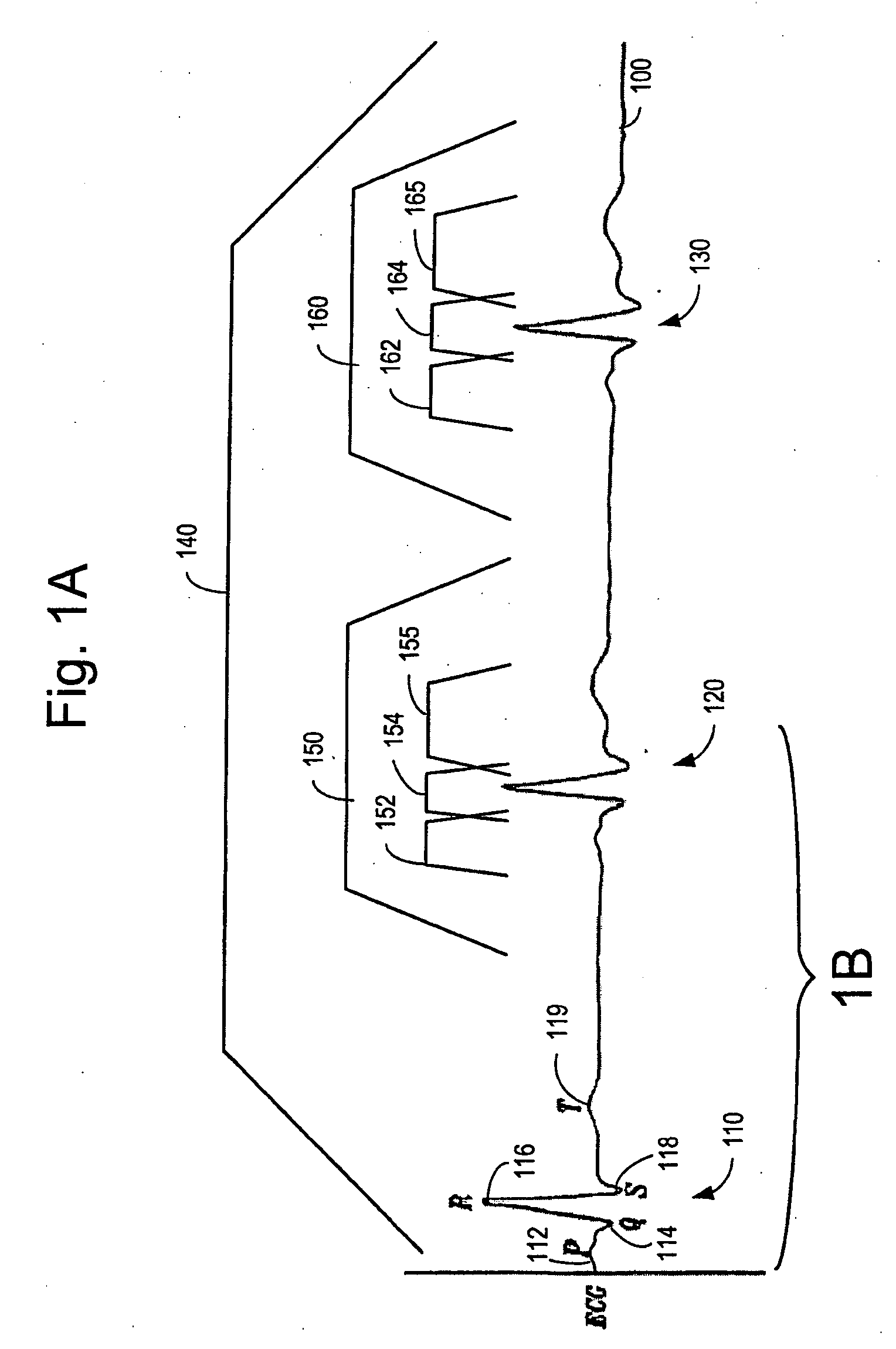 Automatic Capture Verification using Electrocardiograms Sensed from Multiple Implanted Electrodes