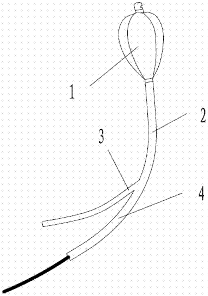 Uterine cavity expansion tri-Lobe balloon catheter