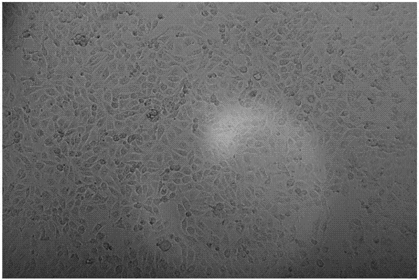 Gene recombination trypsin cell dissociation solution