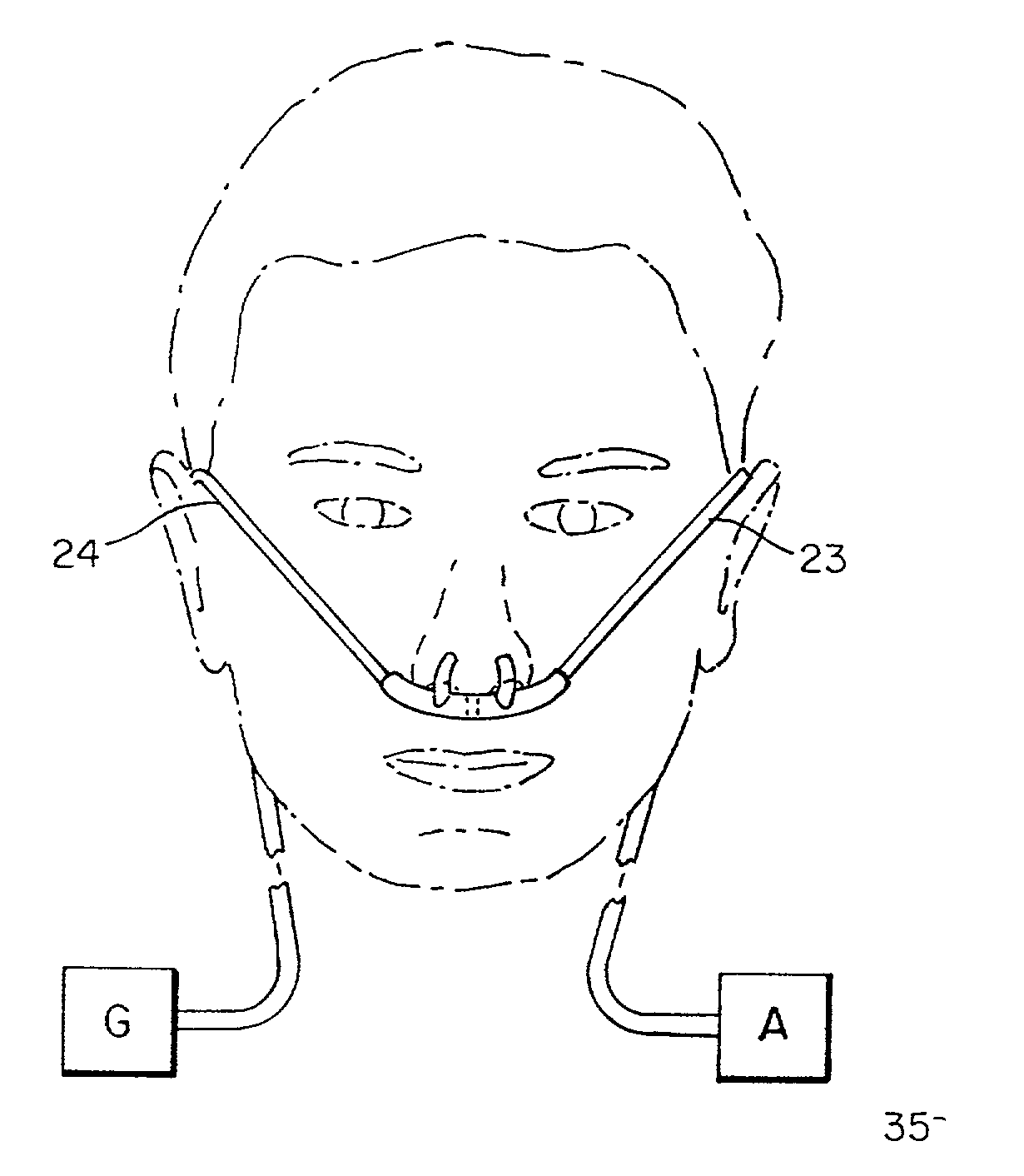 Nasal cannula