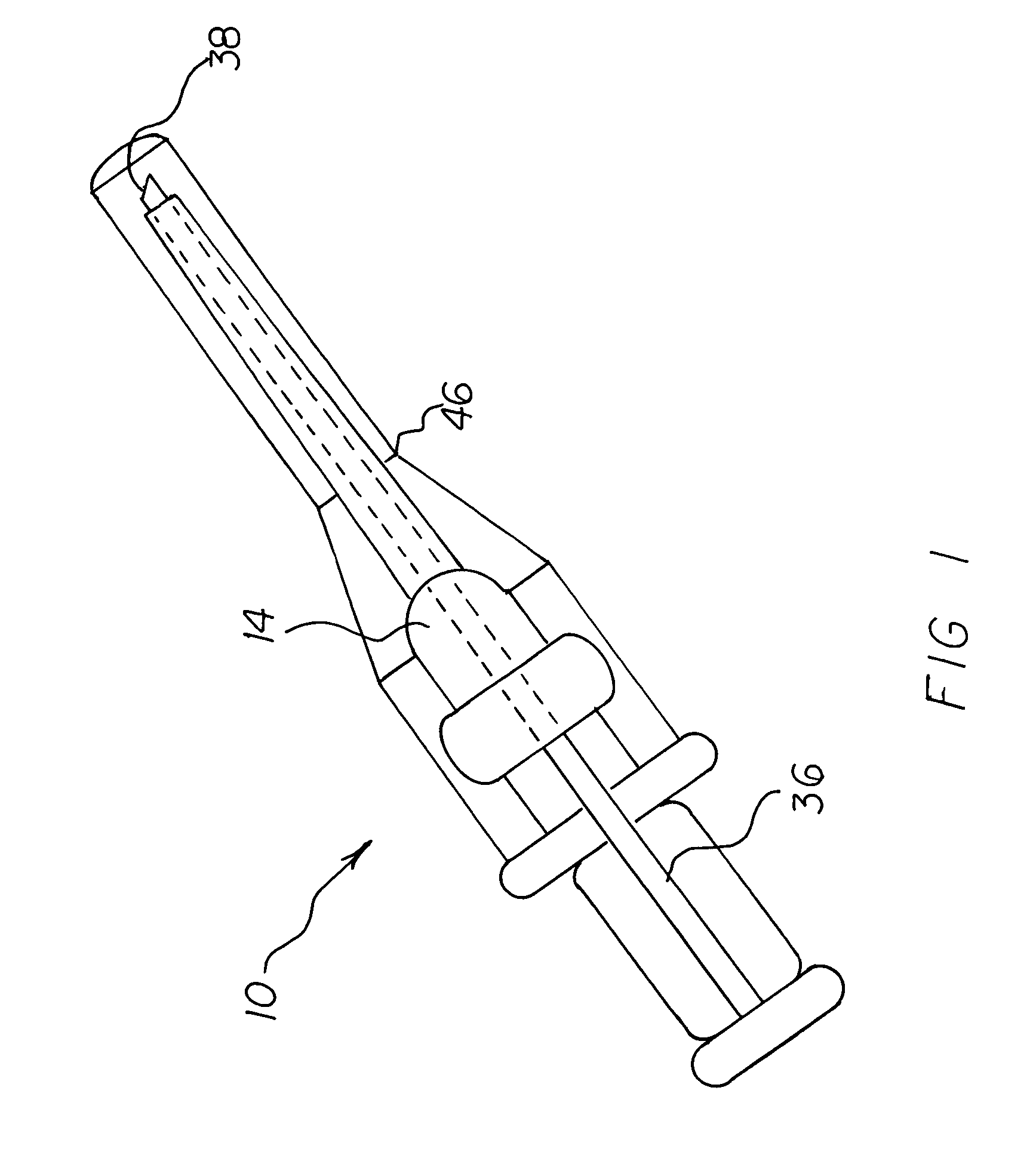 Pneumothorax relief valve method