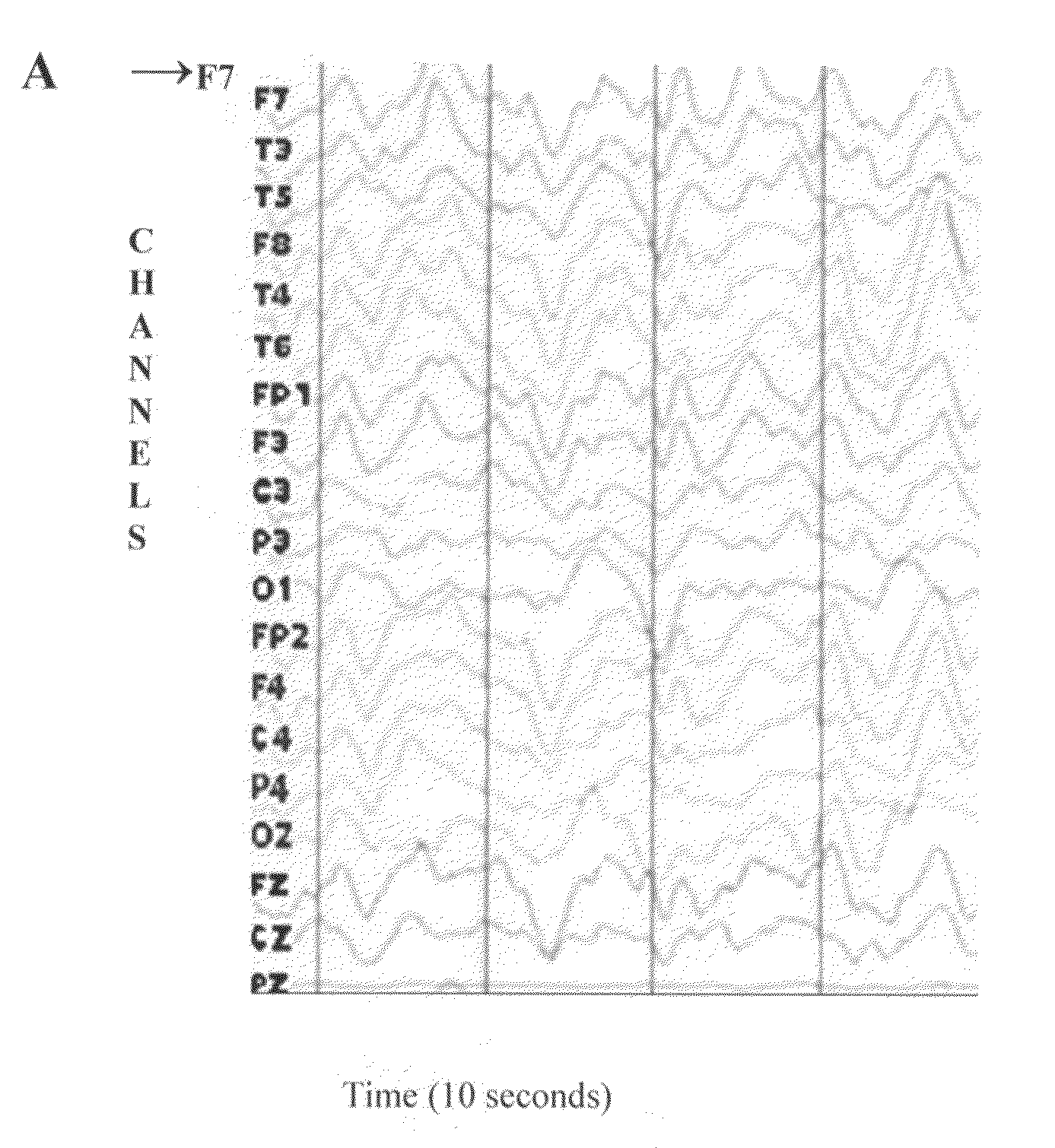 Methods based on fluctuations in cortical synchronization