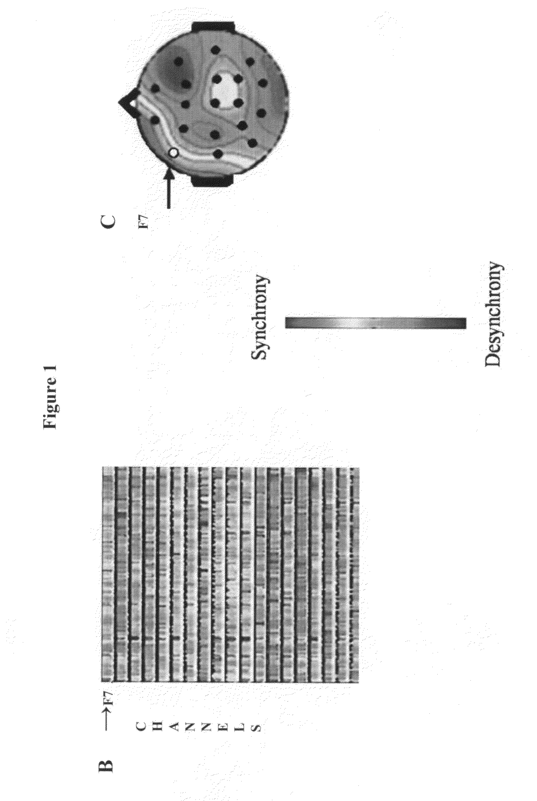 Methods based on fluctuations in cortical synchronization