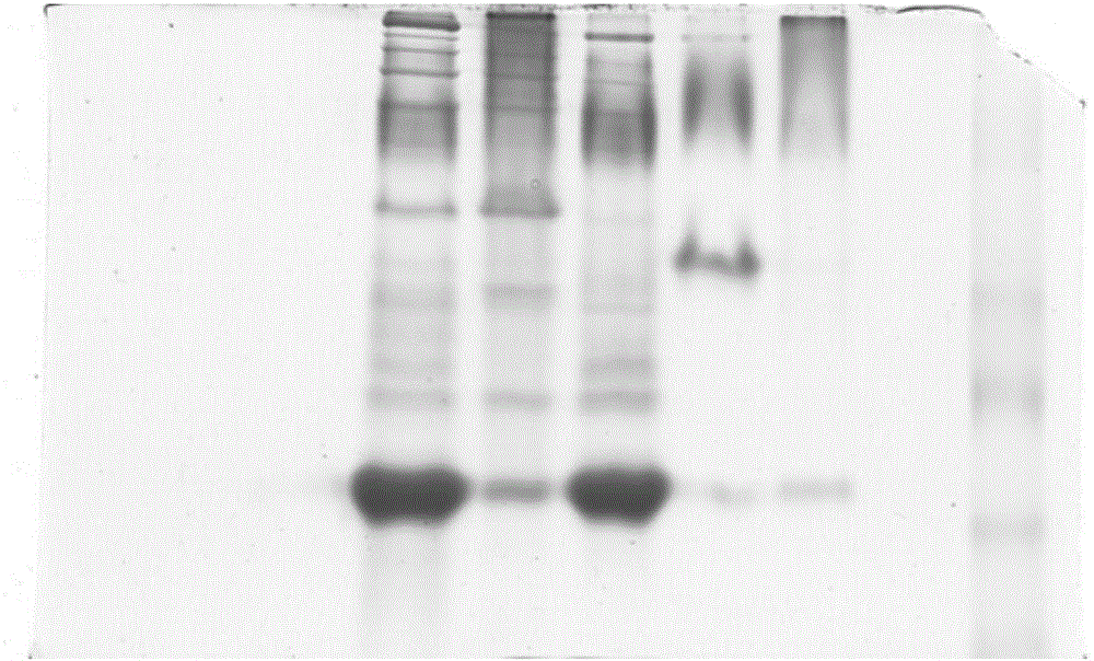 Cadmium-chelated immune complex as well as preparation method and application thereof