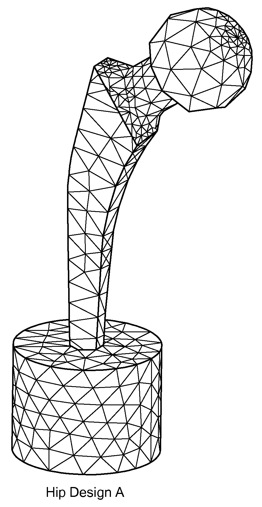 Proximally Self-Locking Long Bone Prosthesis