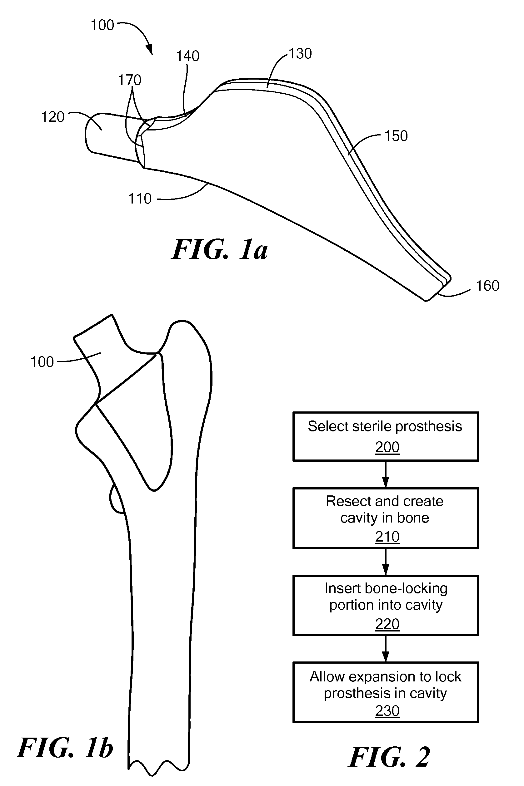 Proximally Self-Locking Long Bone Prosthesis