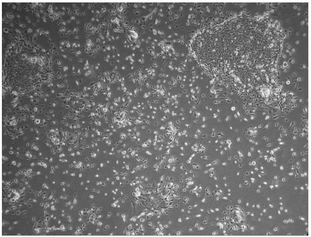 Melanocyte culture method