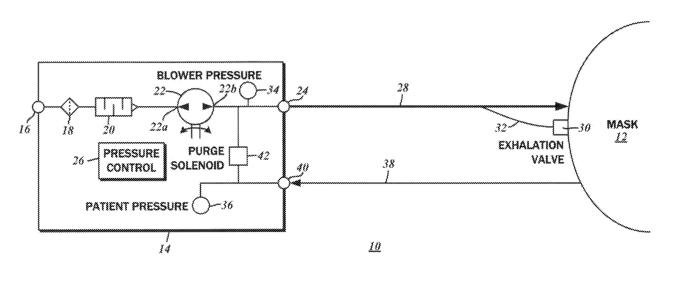 Dual pressure sensor continuous positive airway pressure (CPAP) therapy