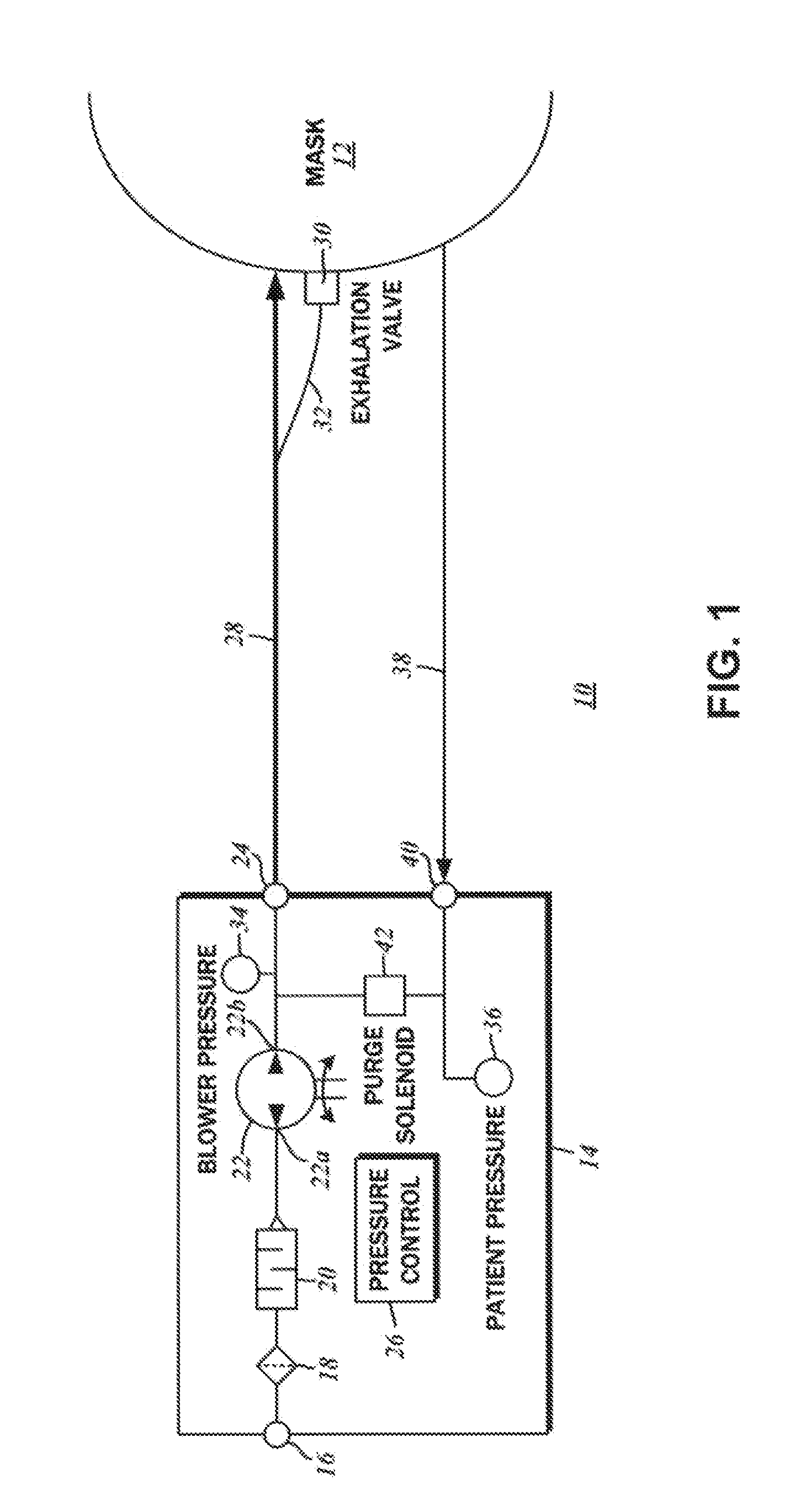 Dual pressure sensor continuous positive airway pressure (CPAP) therapy