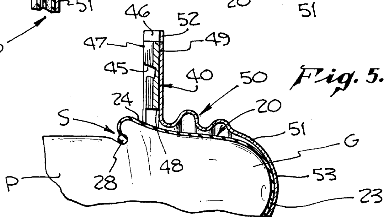 Contoured micro-condom with radially stretching applicator