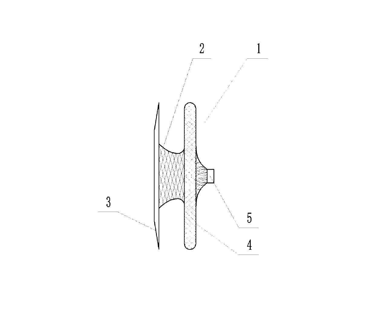 Lightweight atrium and ventricle coloboma occluder