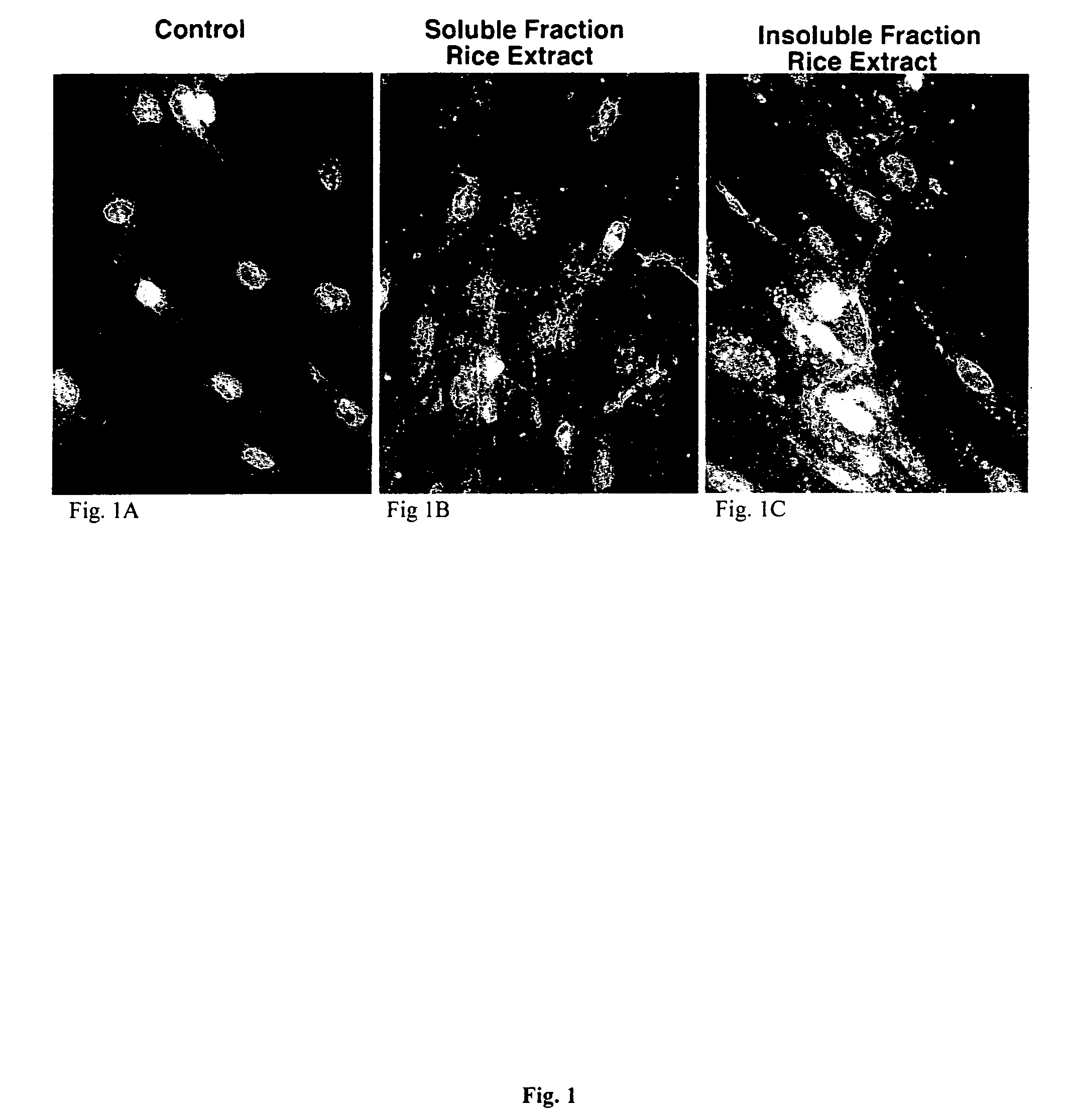 Plant-derived elastin binding protein ligands and methods of using the same