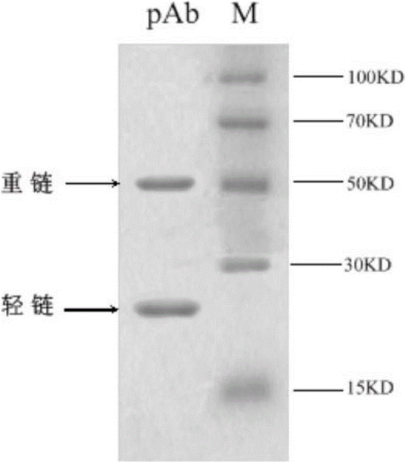 Human procalcitonin immunodetection kit, and preparation method and application thereof