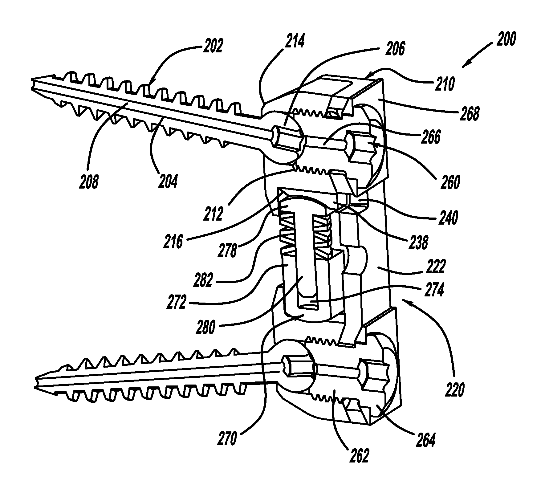 Vertebral disc tensioning device