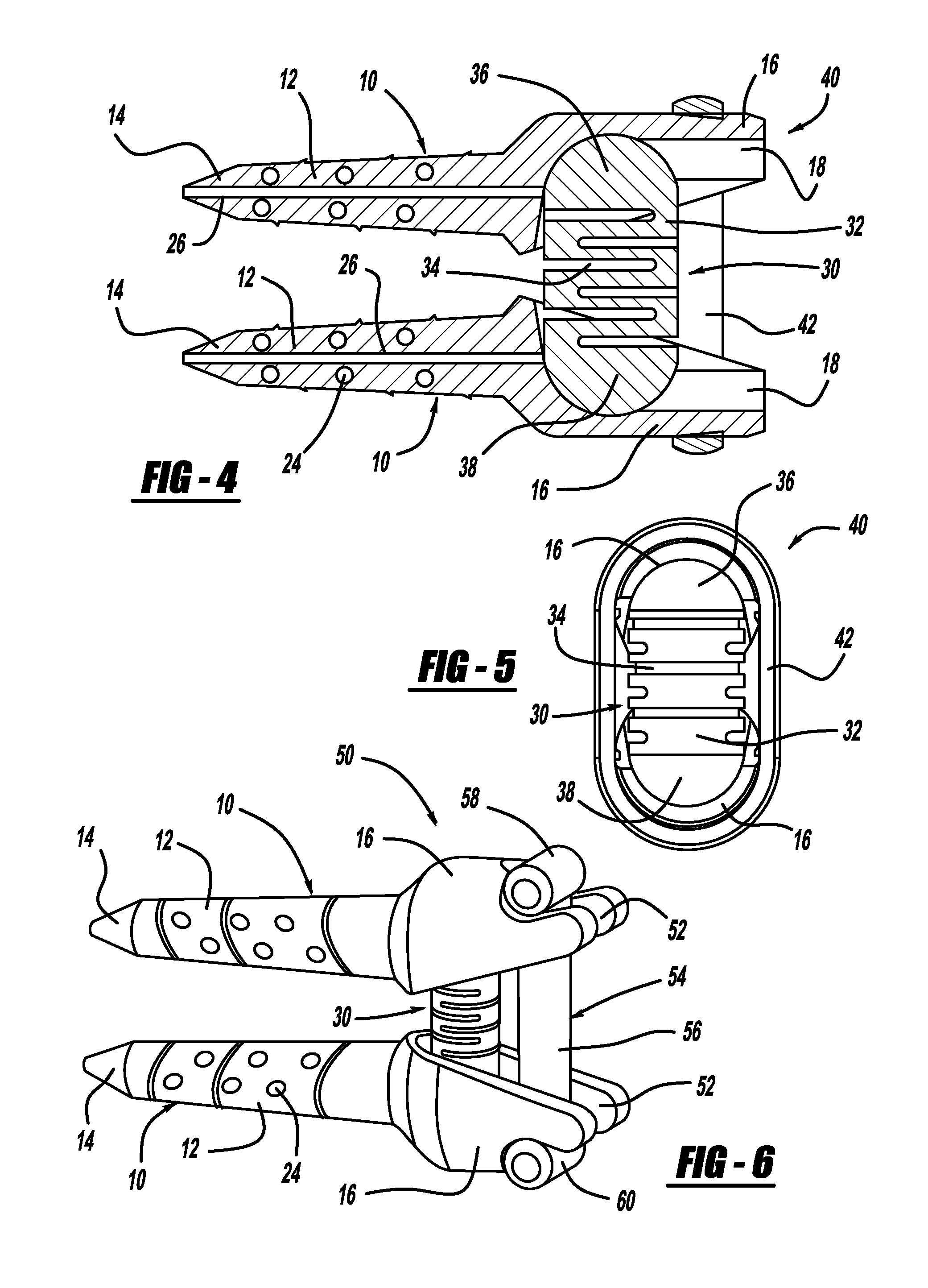 Vertebral disc tensioning device