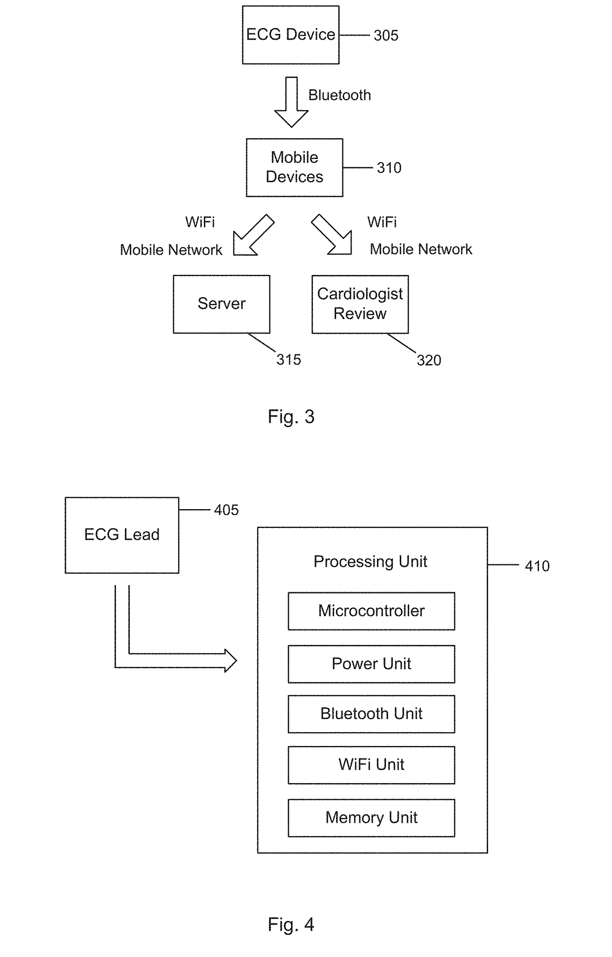 Method of detecting abnormalities in ECG signals