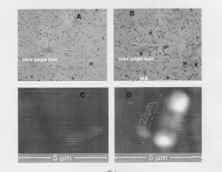 Preparation method of hyaluronic acid