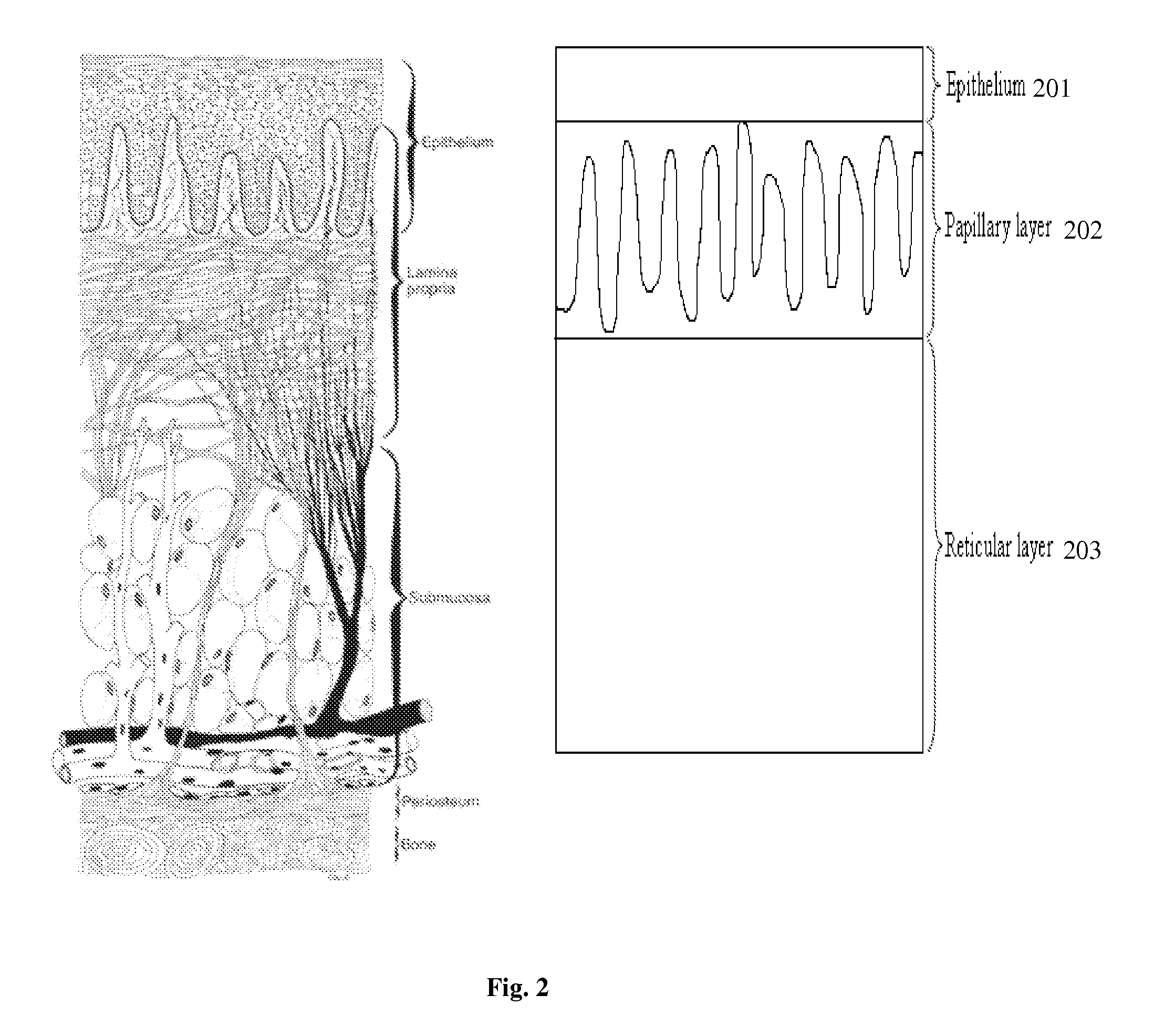 Dental surgical laser with feedback mechanisms