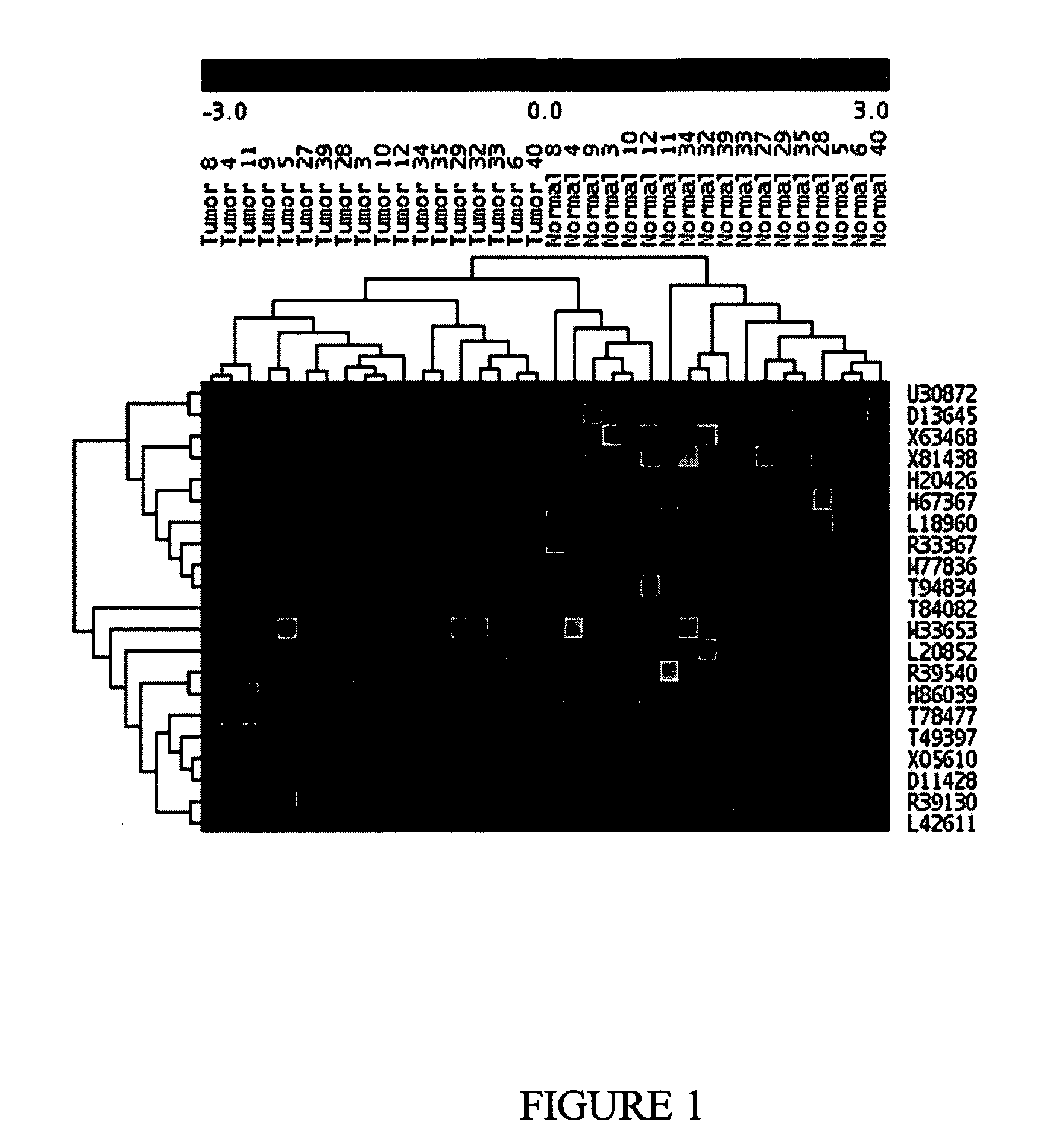 Molecular method for diagnosis of colon cancer