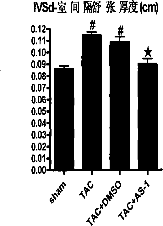 Application of N-[2-methyl-1-(pyrrolidine-1-carbonyl)-propyl]-3-phenyl propionamide in pharmacy