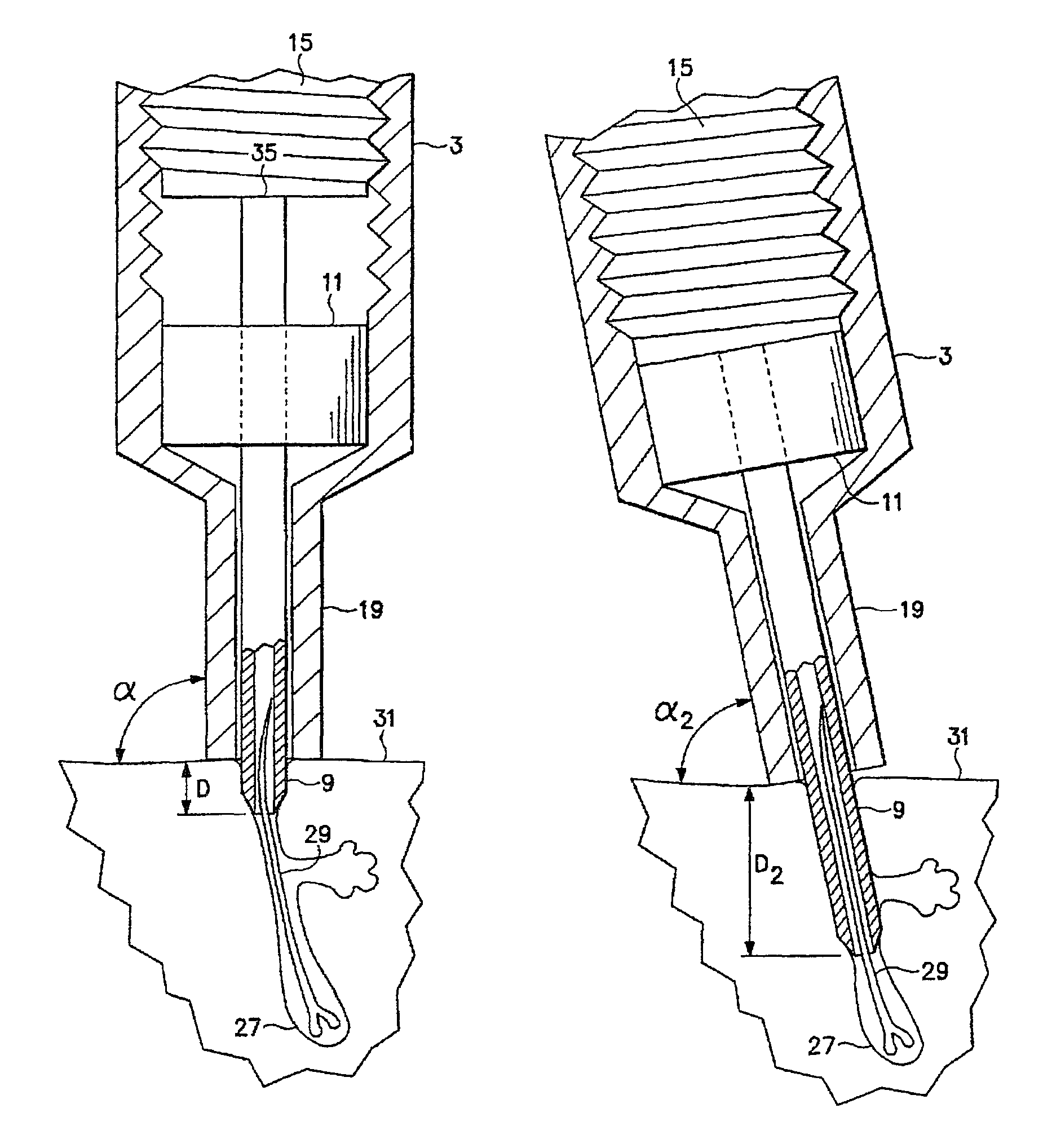 Follicular extraction punch and method