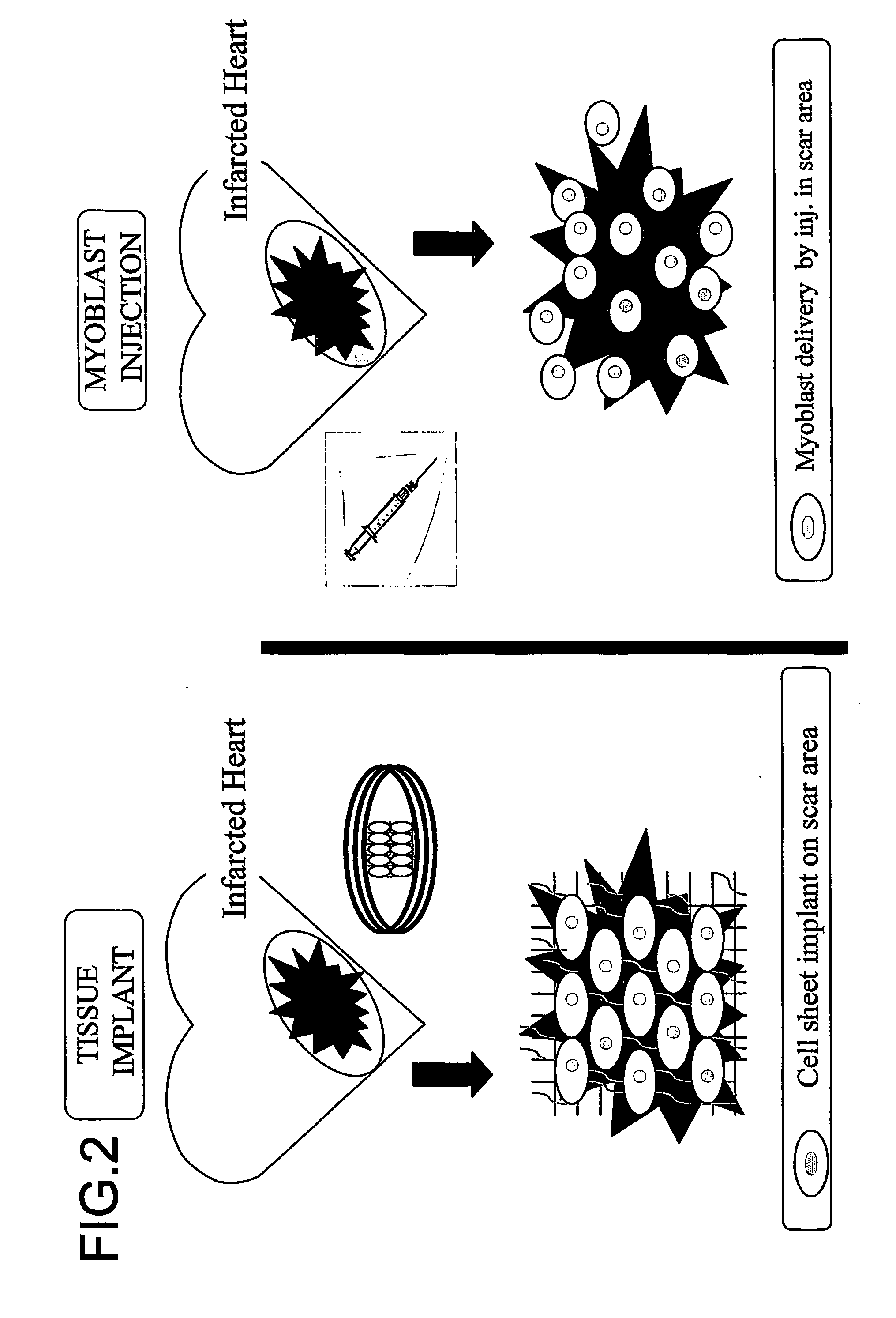 Three-dimentional tissue structure