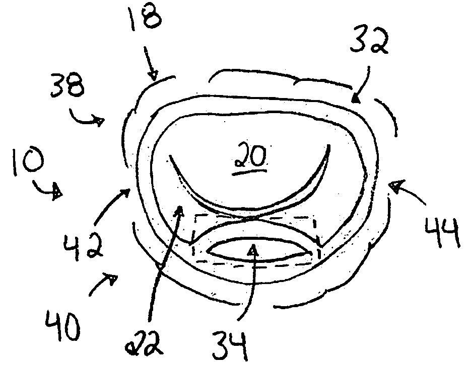 Apparatus and method for treating a regurgitant heart valve