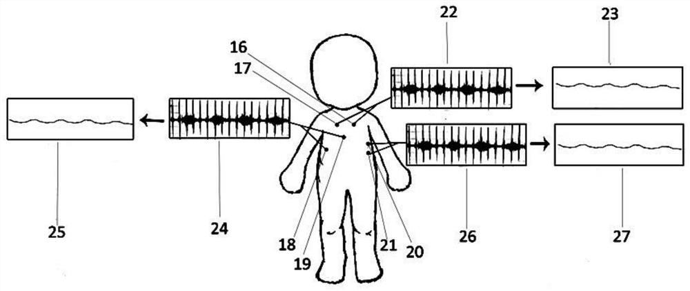 A device for detecting airway reversibility