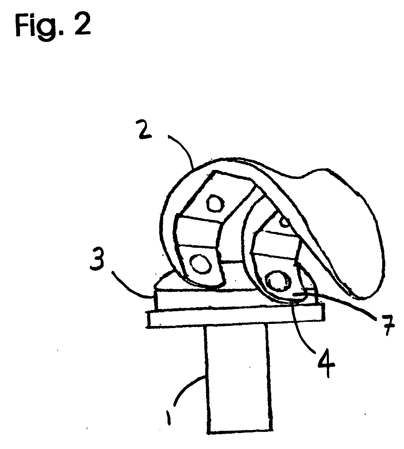 Physiological total knee implant