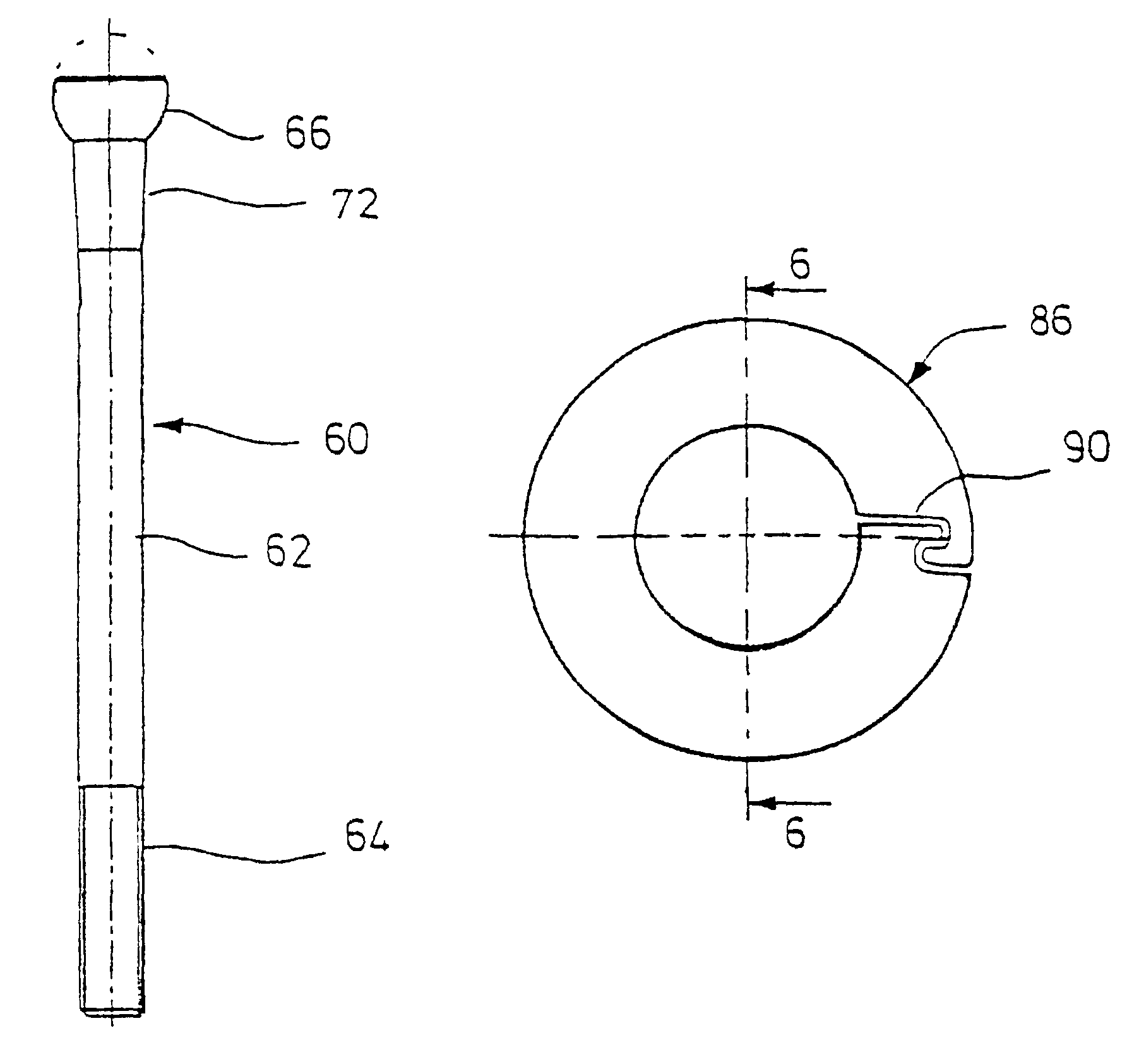 Condylus screw